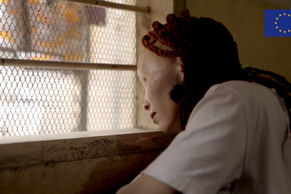 Albinism in Tanzania